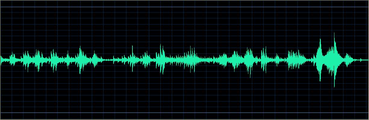 O’Conor waveform