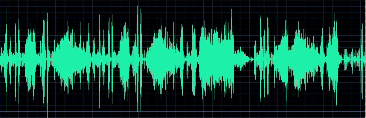 O’Conor waveform
