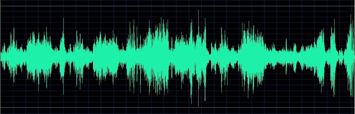 O’Conor waveform