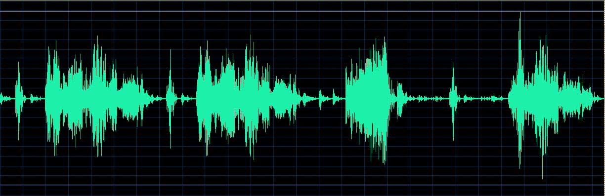 O’Conor waveform