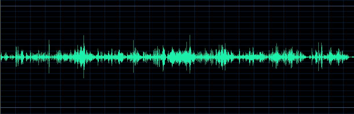 O’Conor waveform