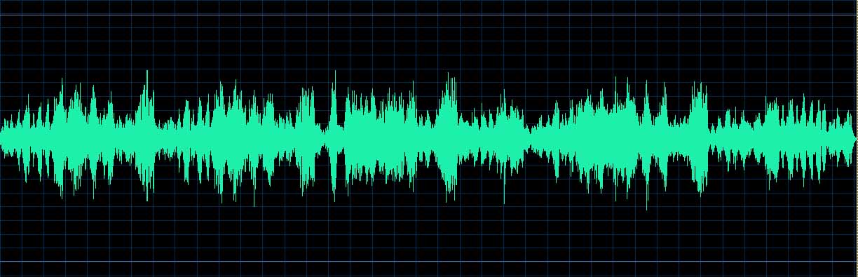 O’Conor waveform
