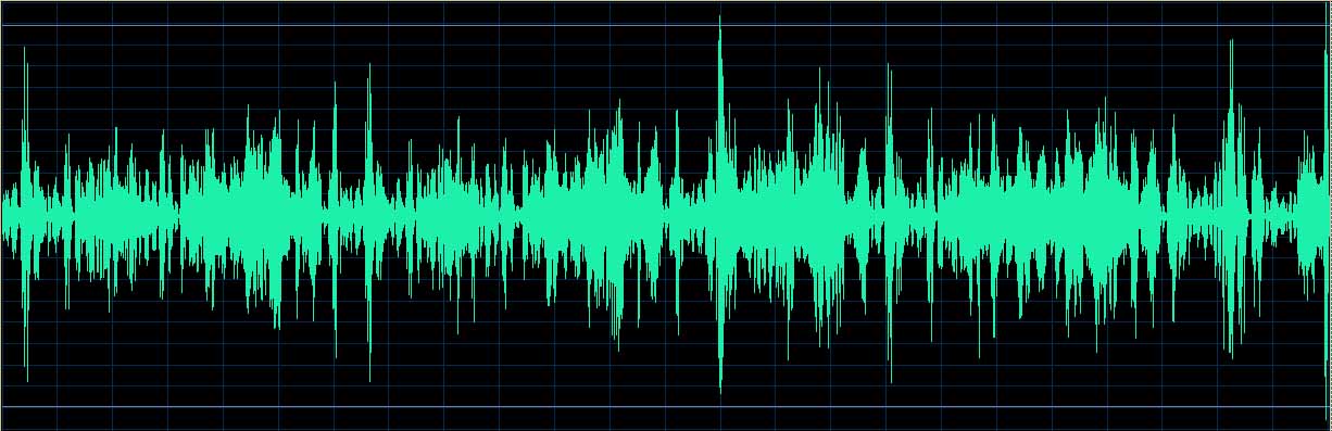 O’Conor waveform