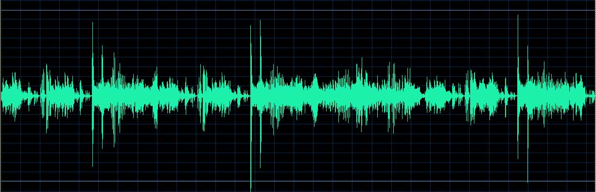 O’Conor waveform