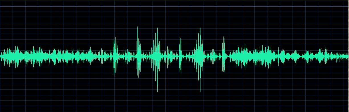 O’Conor waveform