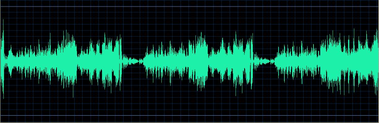 O’Conor waveform