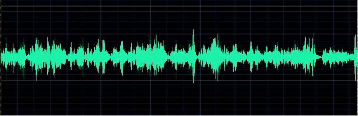 O’Conor waveform