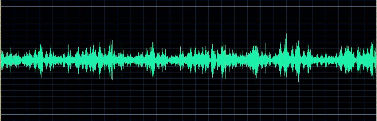 O’Conor waveform