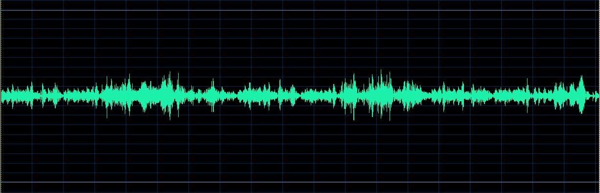 O’Conor waveform