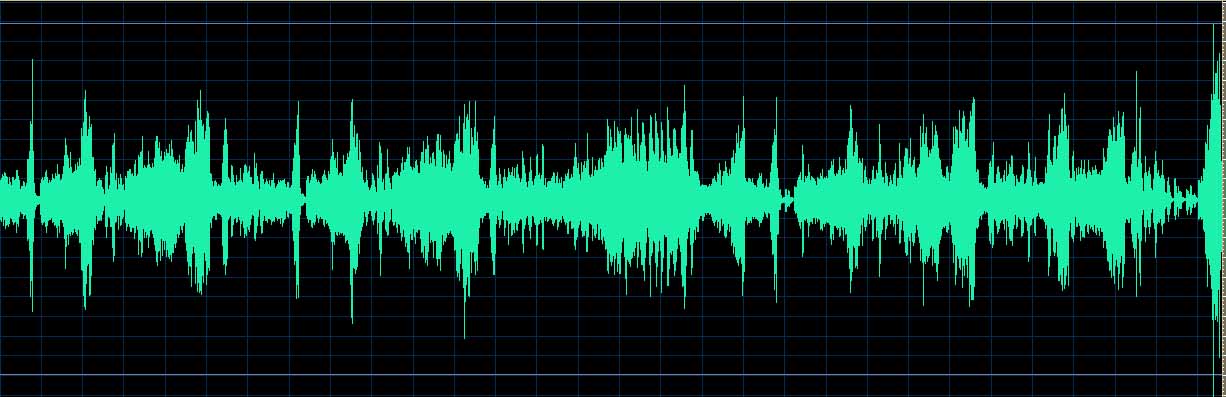 O’Conor waveform