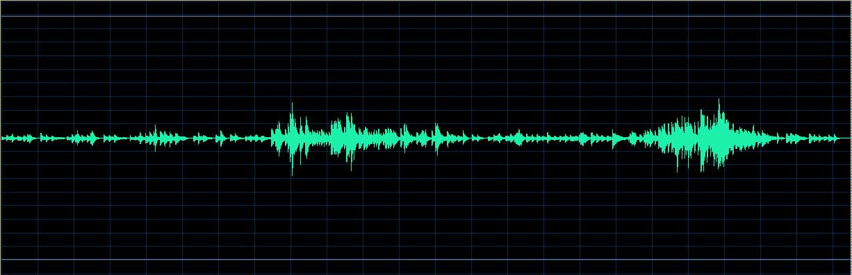 O’Conor waveform