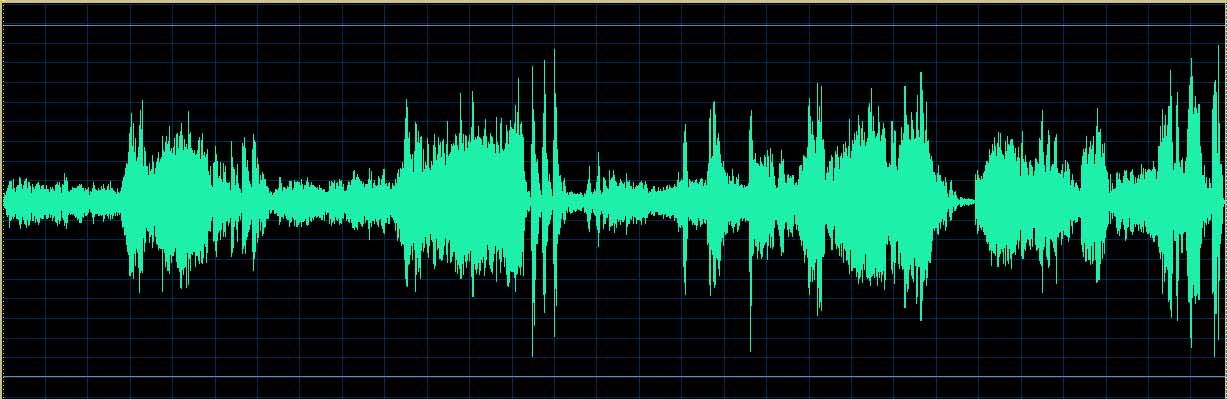 O’Conor waveform