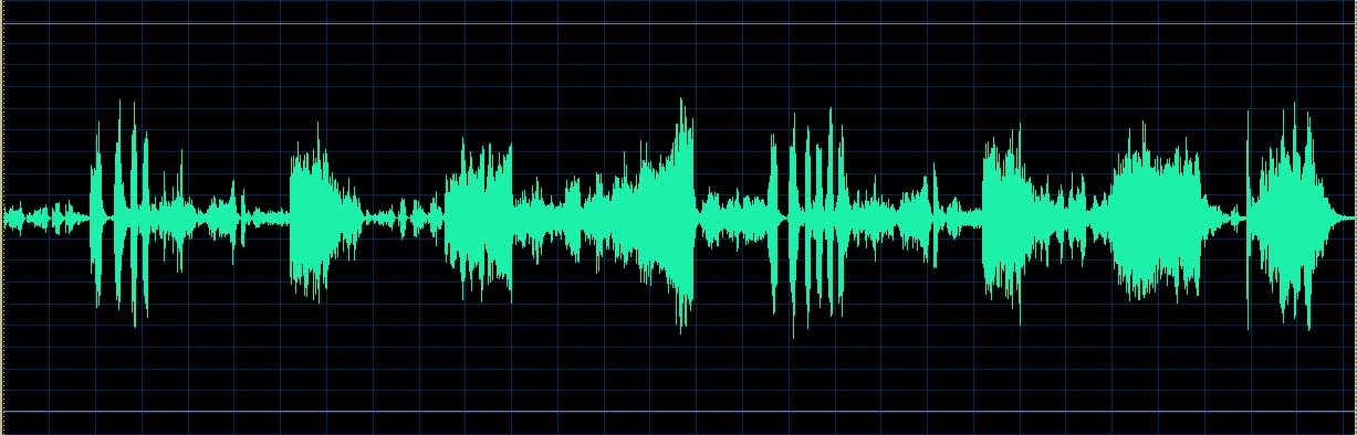 O’Conor waveform
