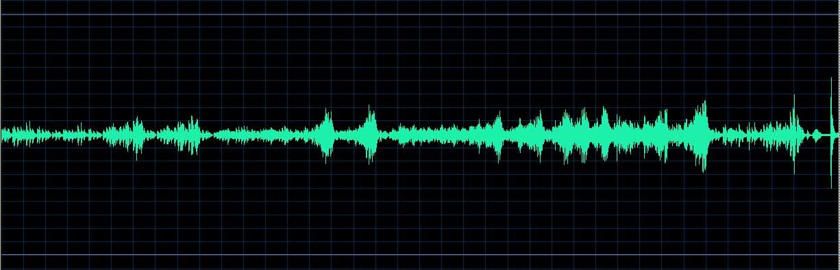 O’Conor waveform