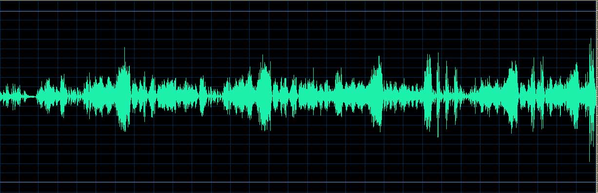 O’Conor waveform