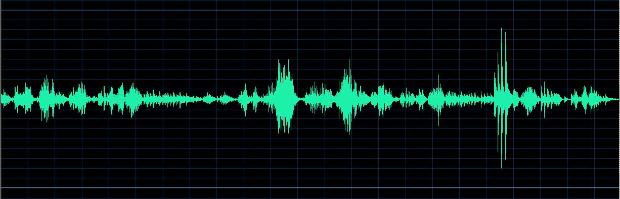 O’Conor waveform