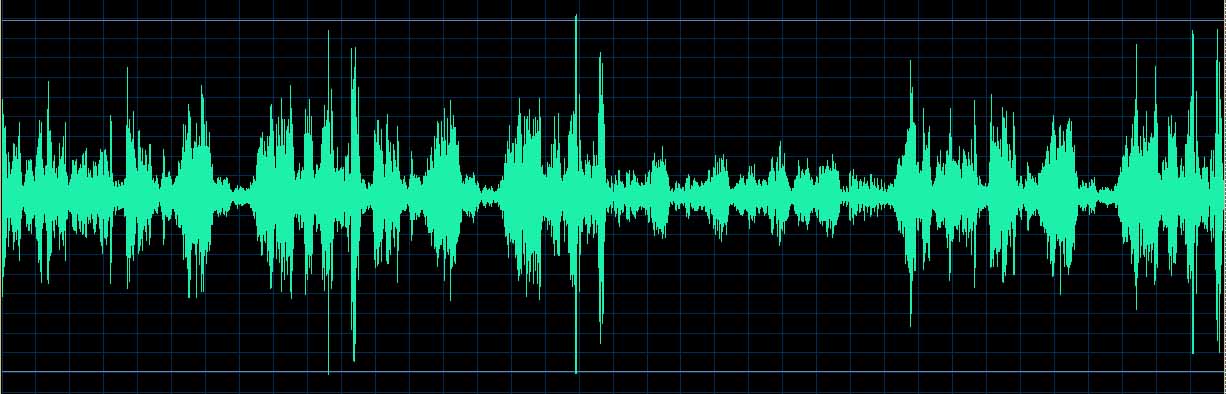 O’Conor waveform