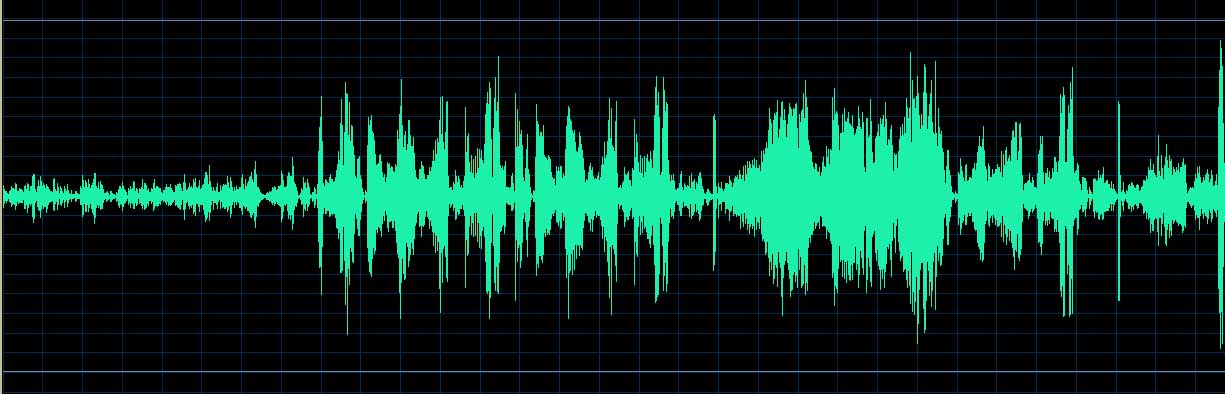 O’Conor waveform