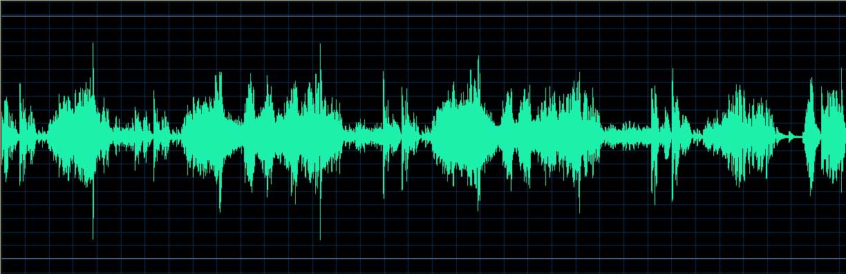 O’Conor waveform