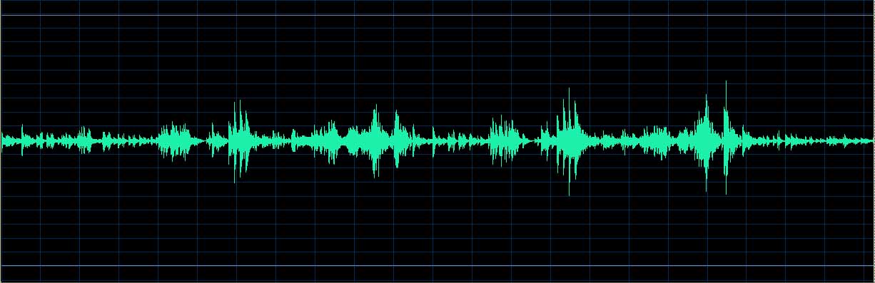 O’Conor waveform