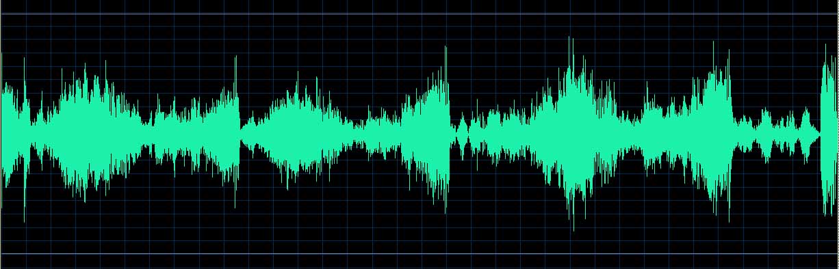 O’Conor waveform