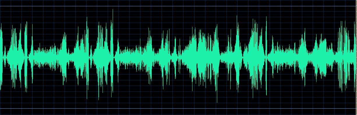 O’Conor waveform
