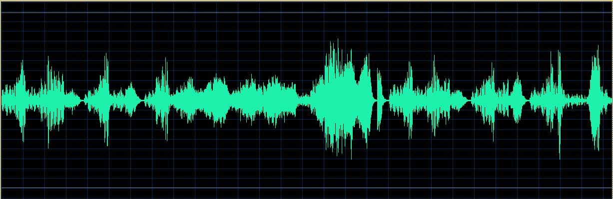 O’Conor waveform