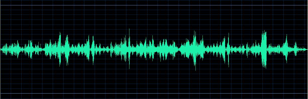 O’Conor waveform