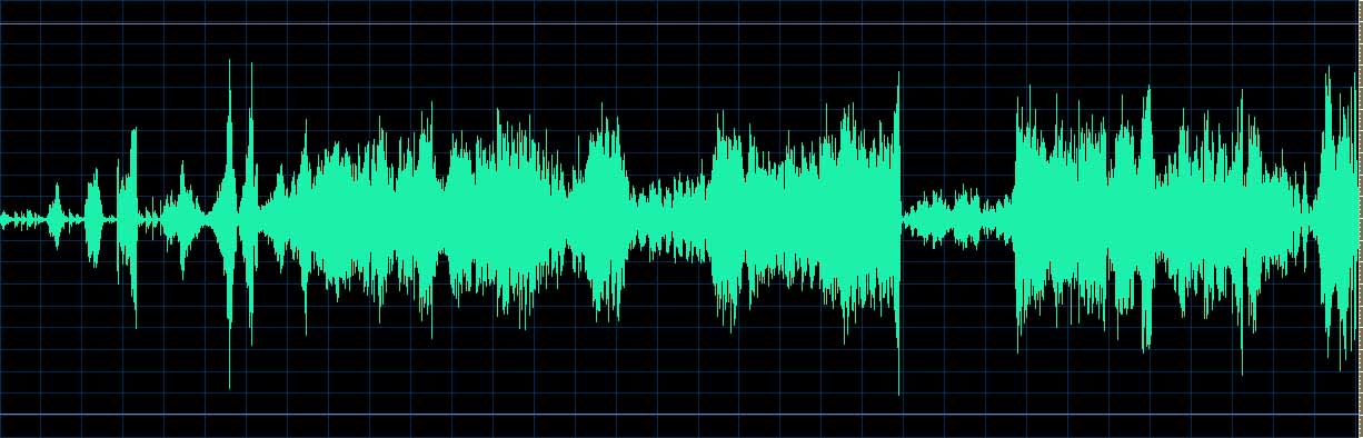 O’Conor waveform