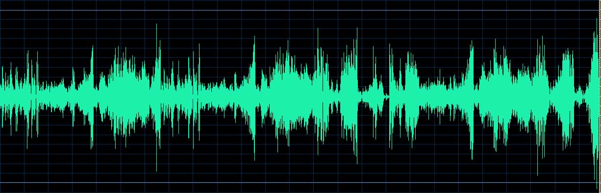 O’Conor waveform