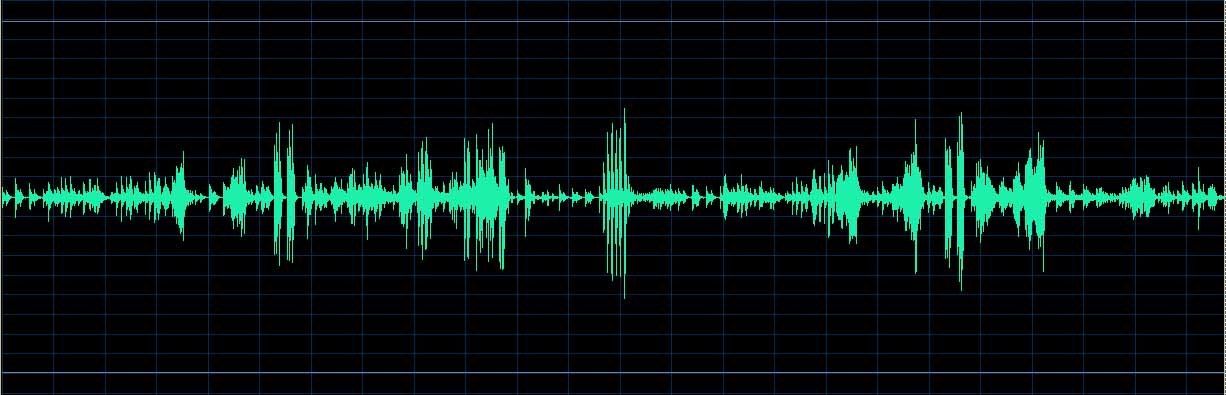 O’Conor waveform