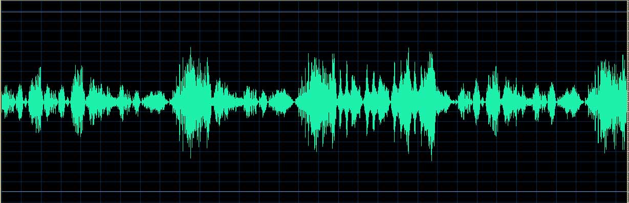 O’Conor waveform