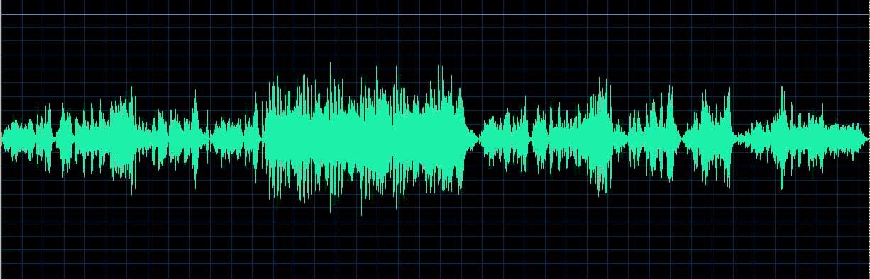 O’Conor waveform