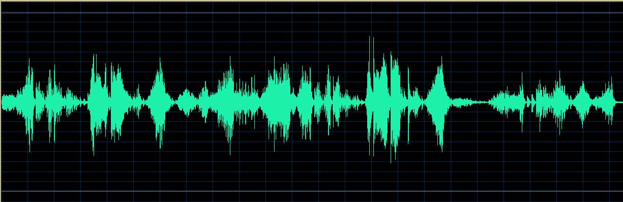 O’Conor waveform