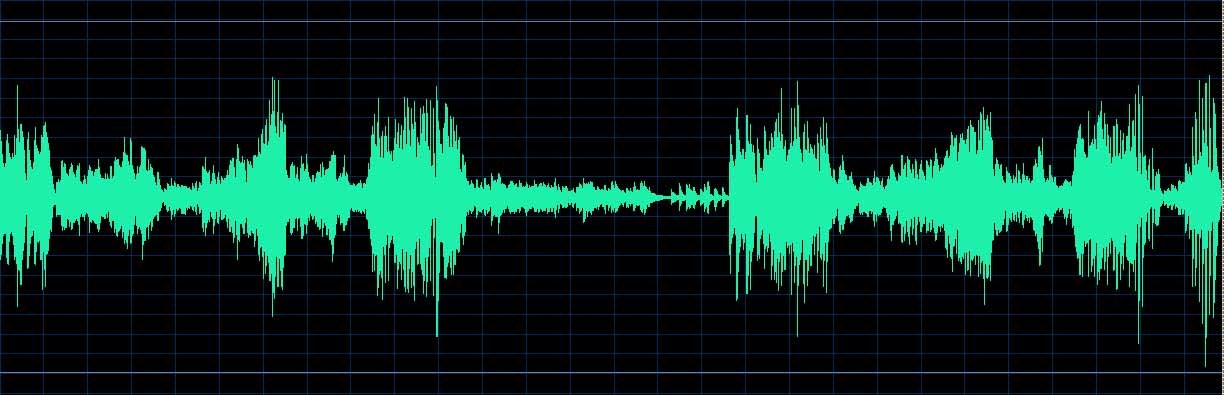 O’Conor waveform