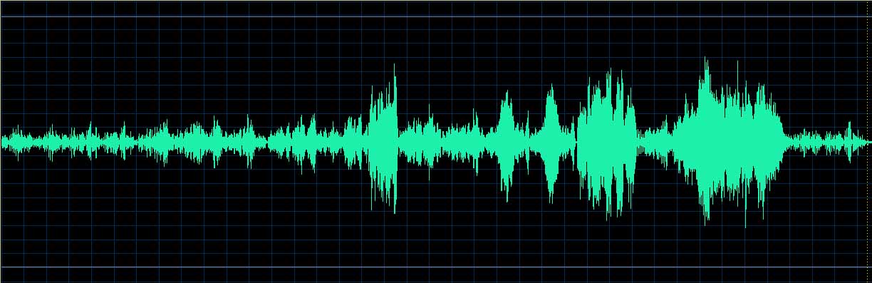 O’Conor waveform