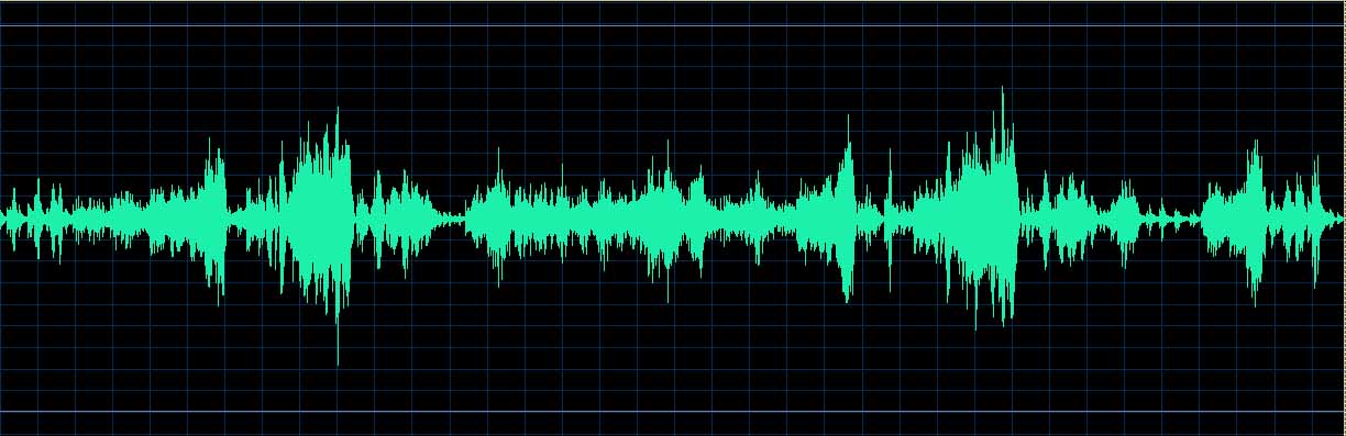 O’Conor waveform