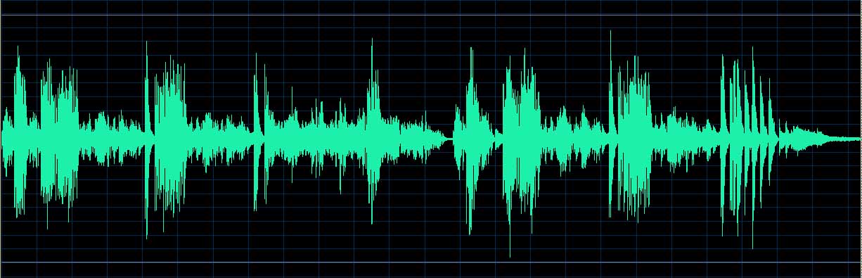 O’Conor waveform