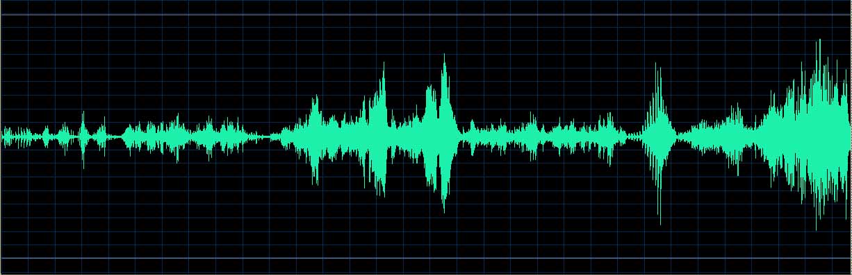 O’Conor waveform