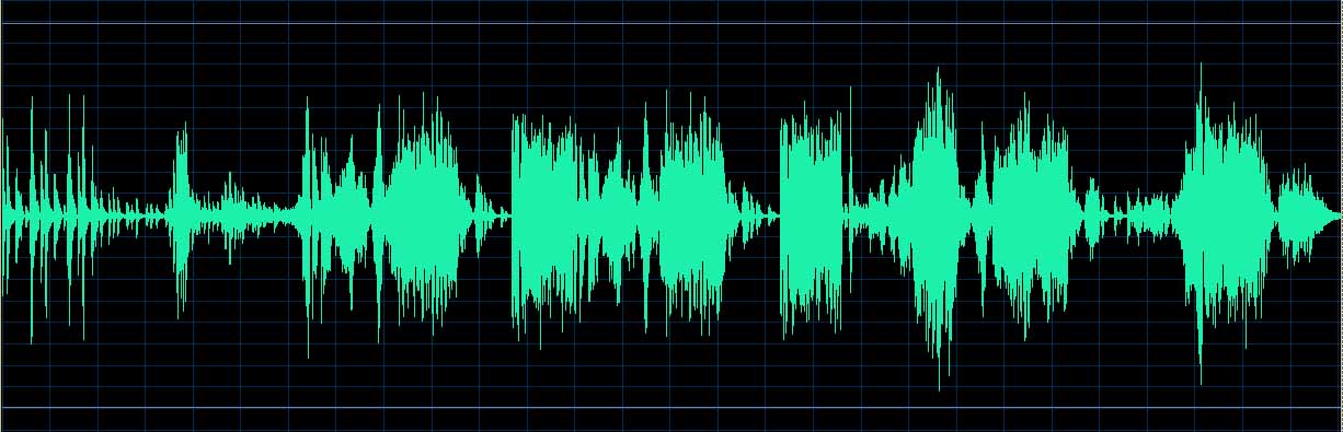 O’Conor waveform