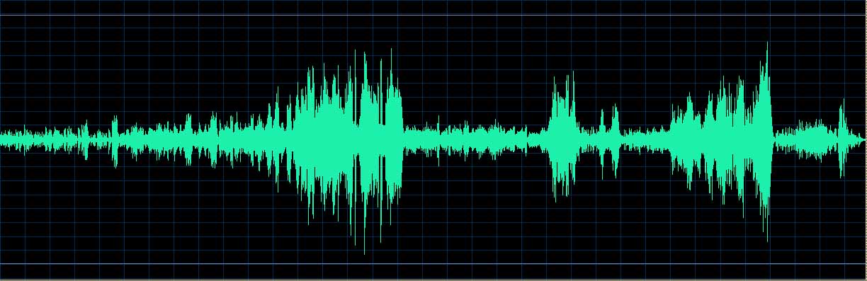O’Conor waveform