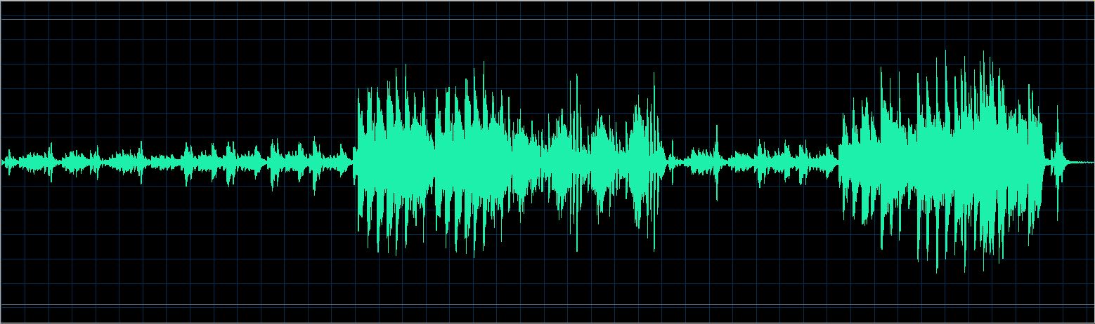 Walter Chodack waveform
