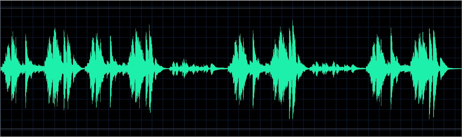 Walter Chodack waveform