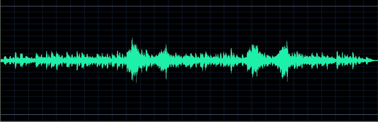 Zilberstein waveform