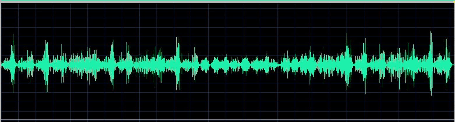 Trzeciak waveform