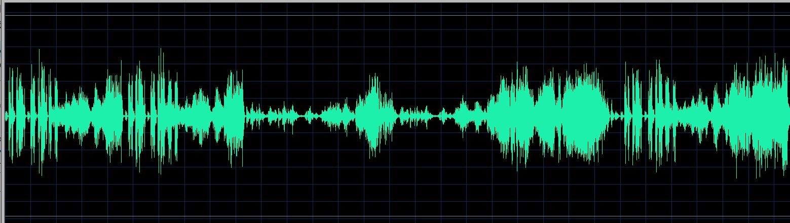 Thibaudet waveform
