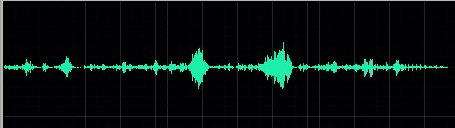 Orozco waveform