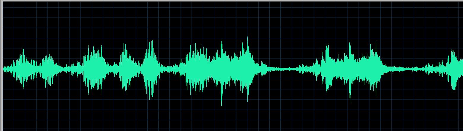 Lortie waveform