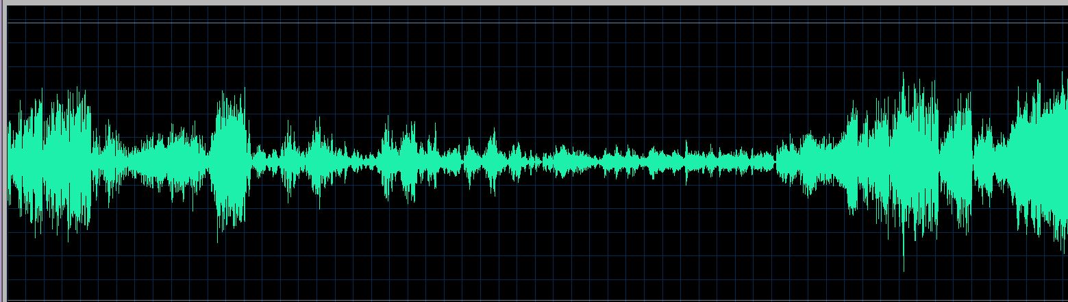 Thibaudet waveform
