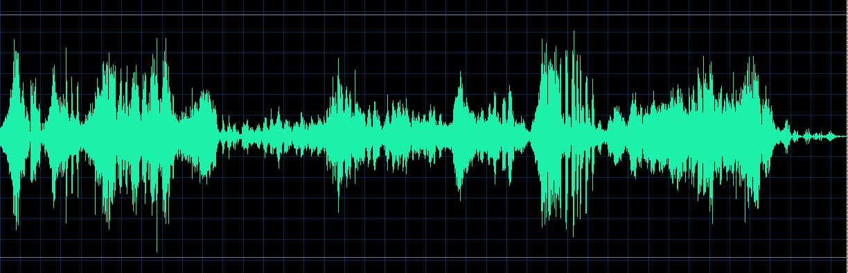 Ronald Brautigam waveform